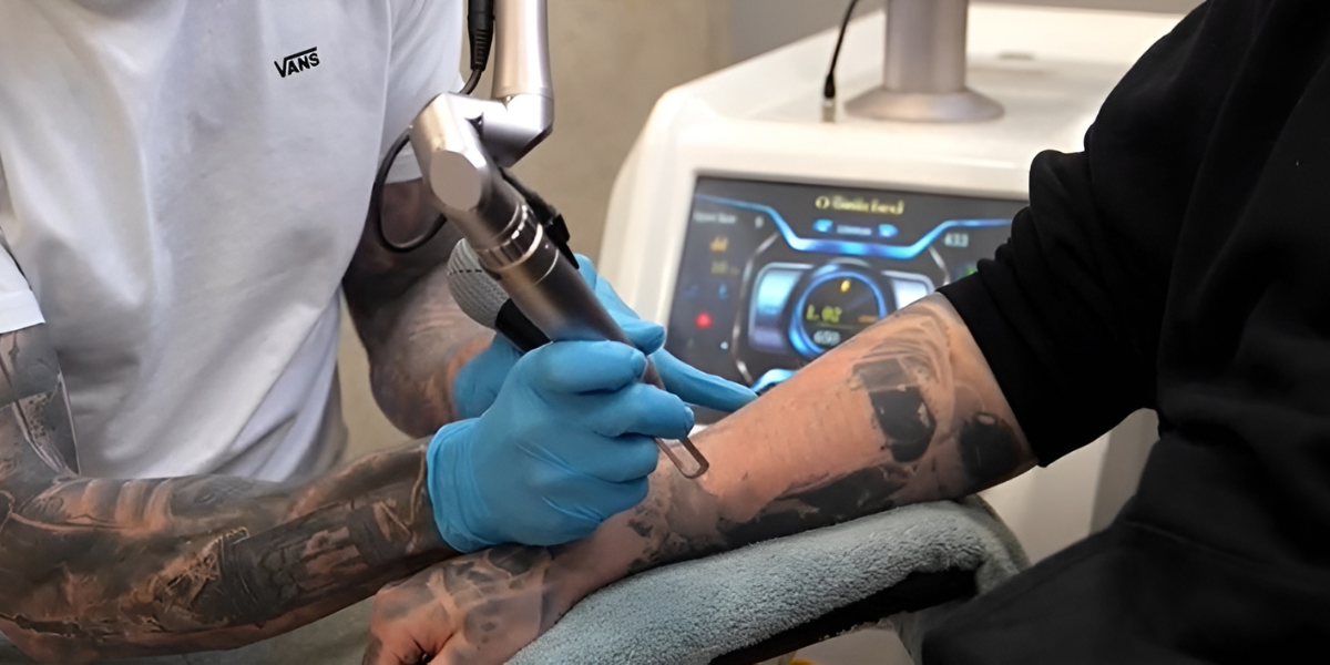 PermaNANO: Tattoo Removal Redefined